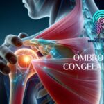 Ombro Congelado: O Que É, Como Tratar