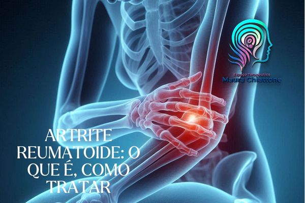 Artrite Reumatoide O que e Como Tratar