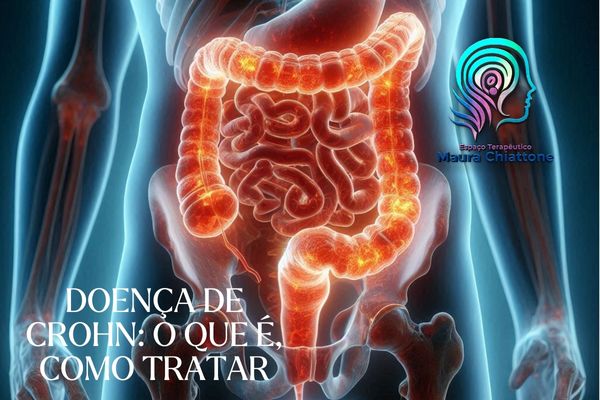 Read more about the article Doença de Crohn: O que é, Como Tratar